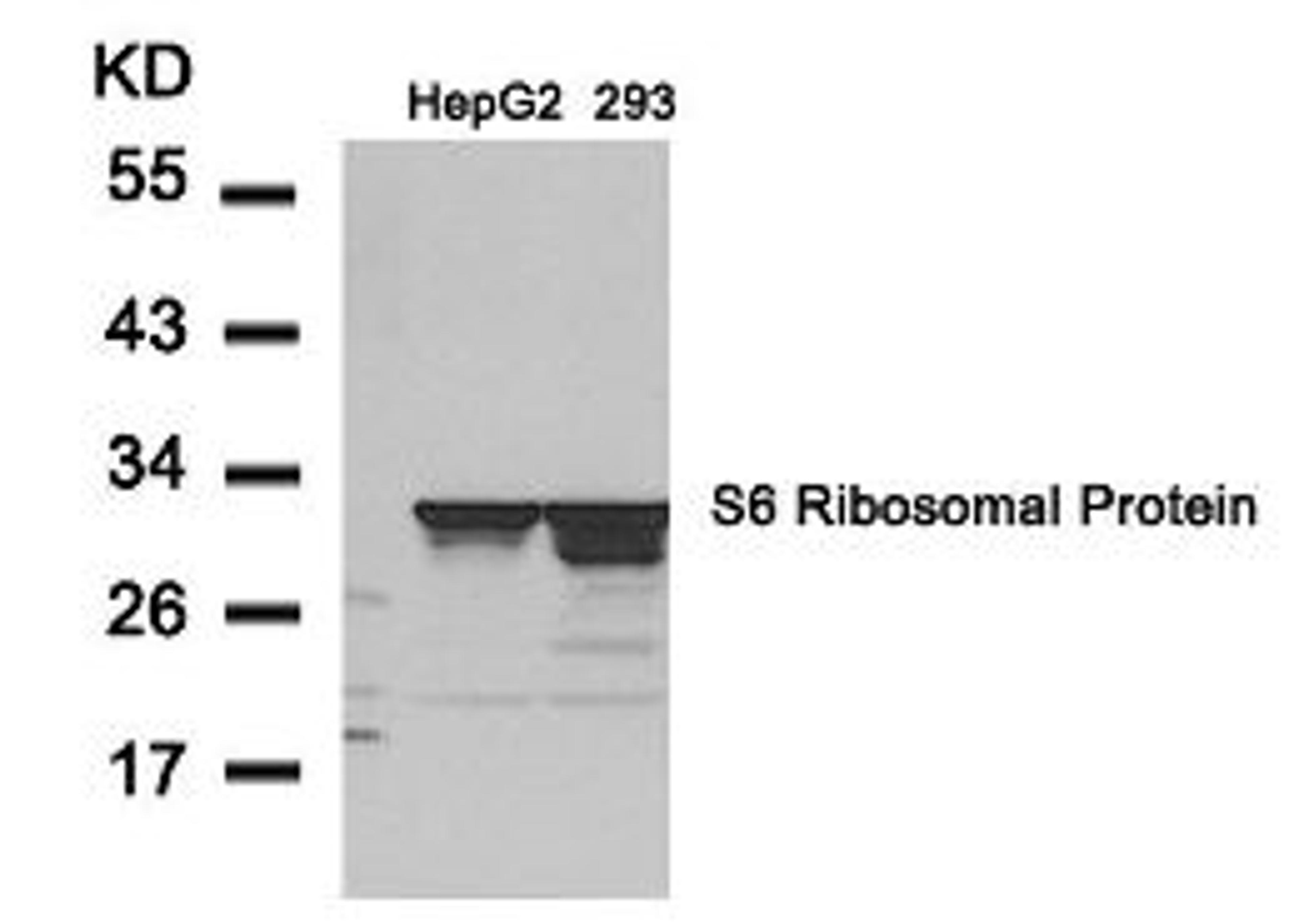 Western blot analysis of lysed extracts from HepG2 and 293 cells using S6 Ribosomal Protein (Ab-235).