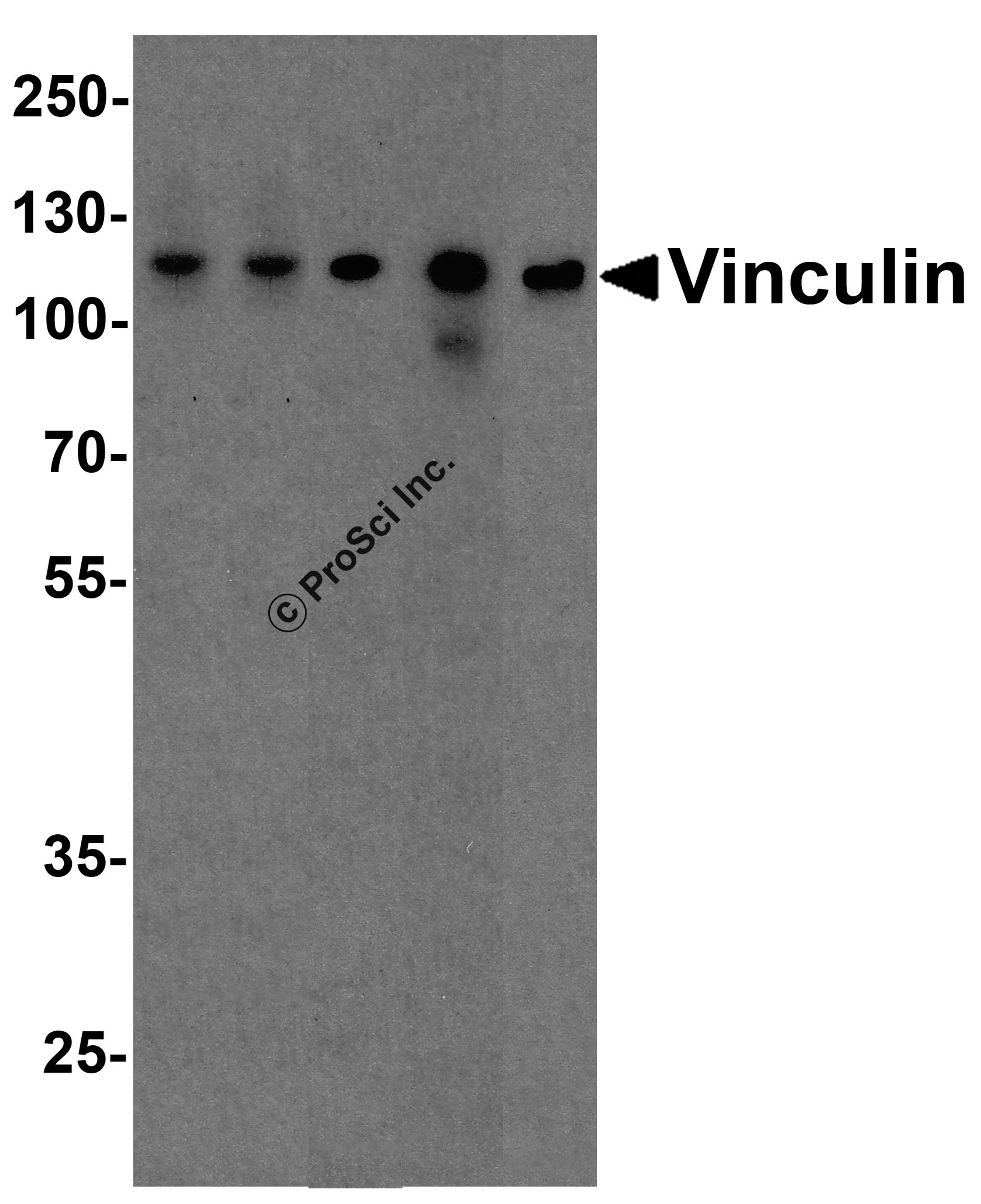 Western blot analysis of Vinculin in A431, Daudi, Jurkat, Raji, and THP-1 cell lysate with Vinculin antibody at 1 μg/ml.