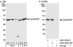 Detection of human and mouse Cdc42GAP by western blot (h&m) and immunoprecipitation (h).