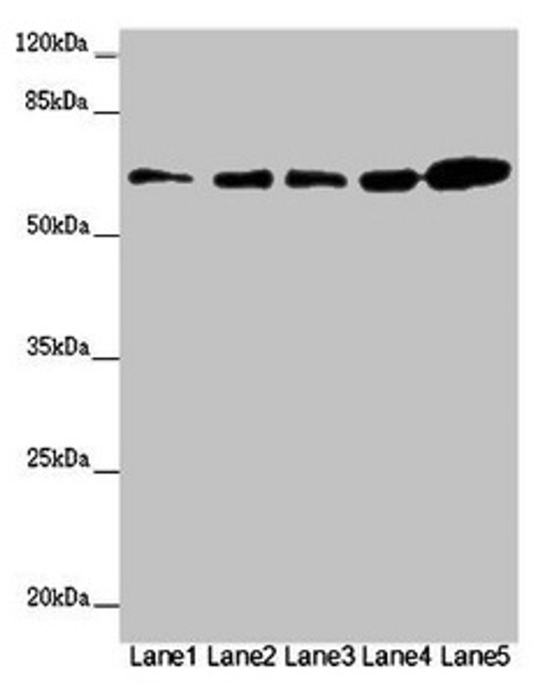 Western blot. All lanes: ZBTB46 antibody at 2ug/ml. Lane 1: Mouse heart tissue. Lane 2: Mouse liver tissue. Lane 3: Mouse kidney tissue. Lane 4: 293T whole cell lysate. Lane 5: SH-SY5Y whole cell lysate. Secondary. Goat polyclonal to rabbit IgG at 1/10000 dilution. Predicted band size: 65 kDa. Observed band size: 65 kDa. 