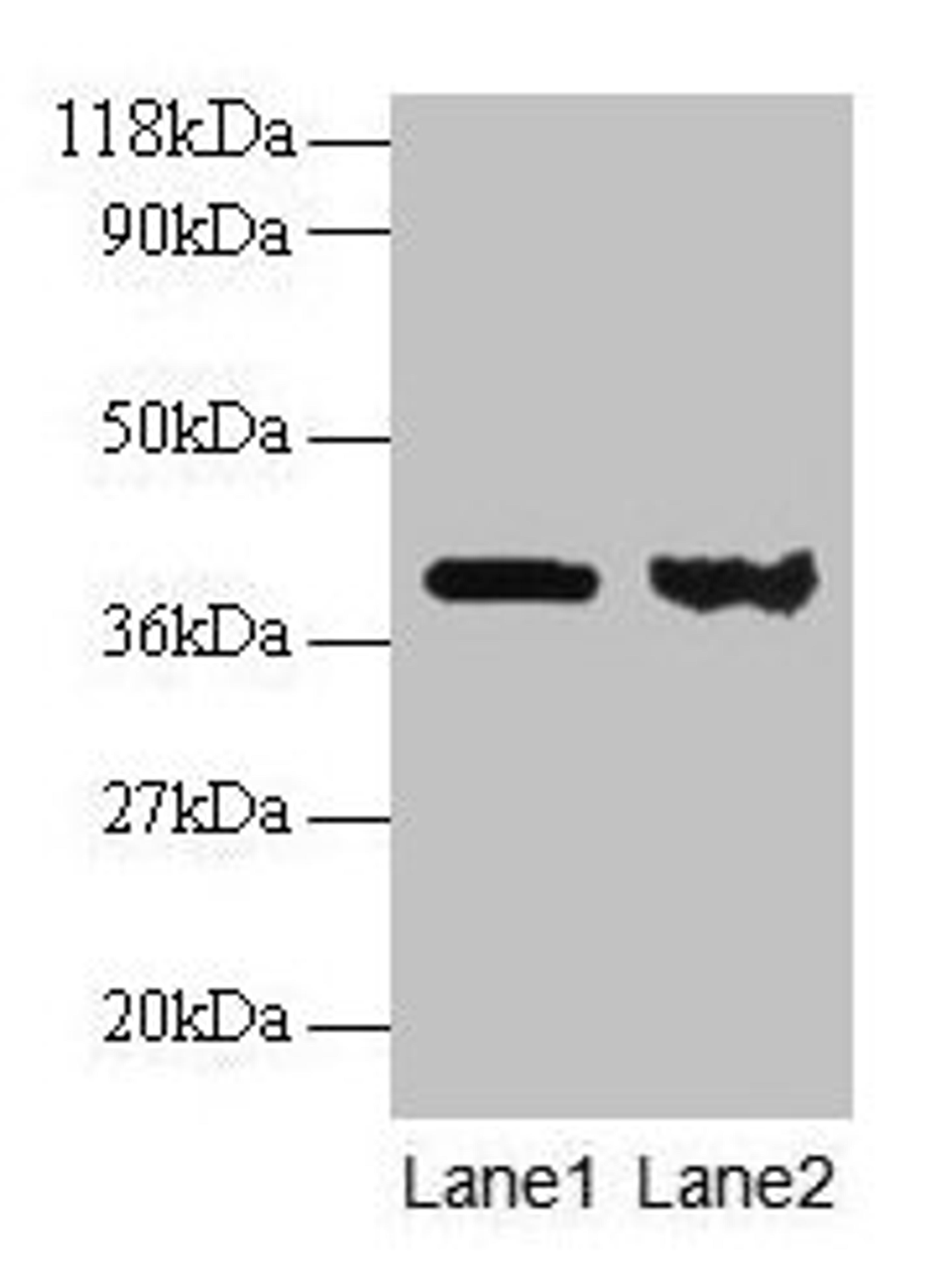 Western blot. All lanes: ARHGDIA antibody at 1:500. Lane 1: EC109 whole cell lysate. Lane 2: 293T whole cell lysate. Secondary. Goat polyclonal to rabbit IgG at 1/15000 dilution. Predicted band size: 24, 19 kDa. Observed band size: 40 kDa