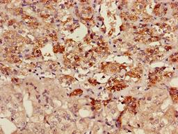 Immunohistochemistry of paraffin-embedded human adrenal gland tissue using CSB-PA001529LA01HU at dilution of 1:100