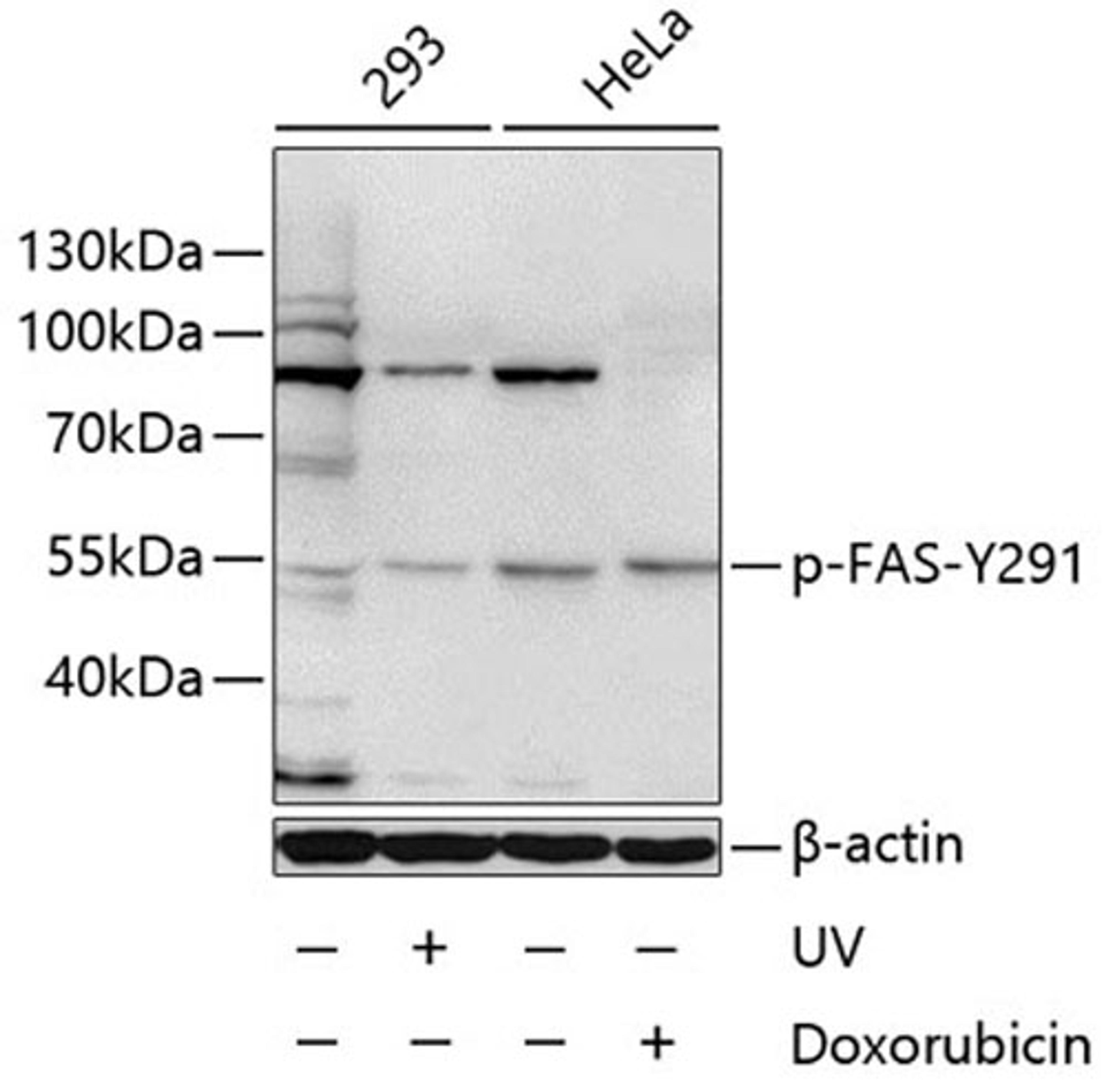 Western blot - Phospho-FAS-Y291 antibody (AP0007)