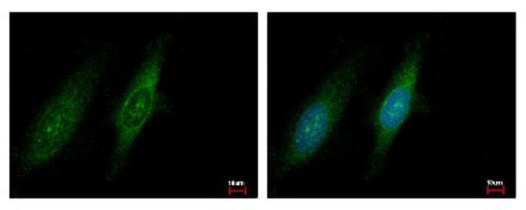 Immunocytochemistry/Immunofluorescence: GCN2 Antibody [NBP1-31679] - Sample: HeLa cells were fixed in iced-cold MeOH for 5 min. Green: EIF2AK4 protein stained by GCN2 antibody, C-term diluted at 1:500. Blue: Hoechst 33343 staining.