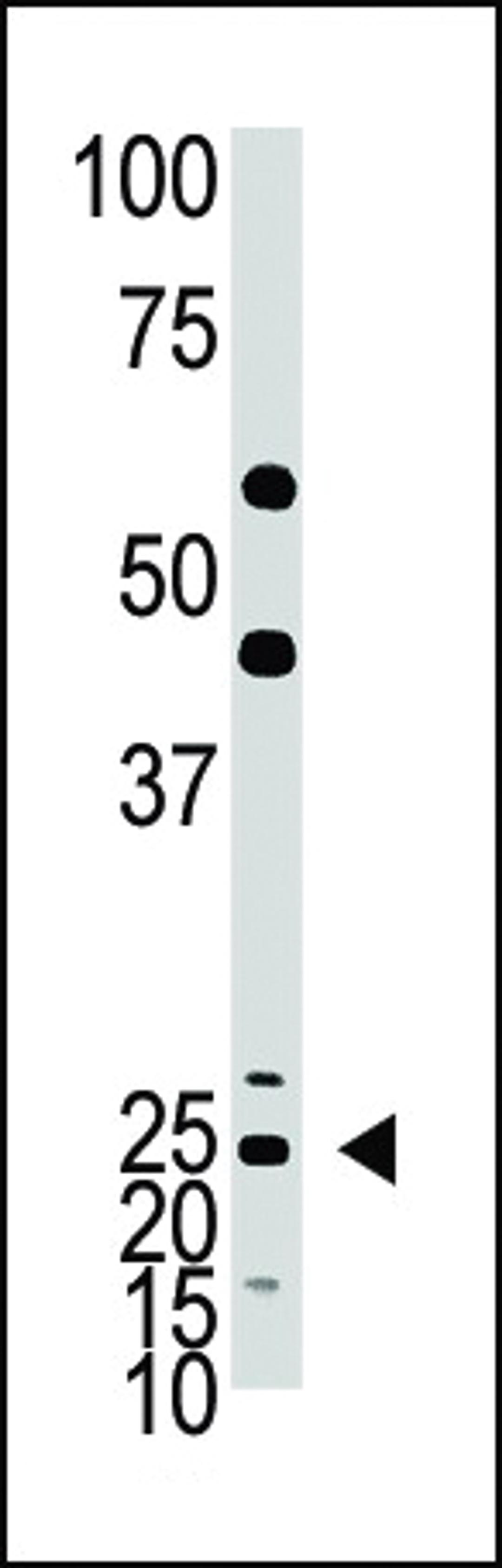 Antibody is used in Western blot to detect Hash1 in mouse lung tissue lysate.