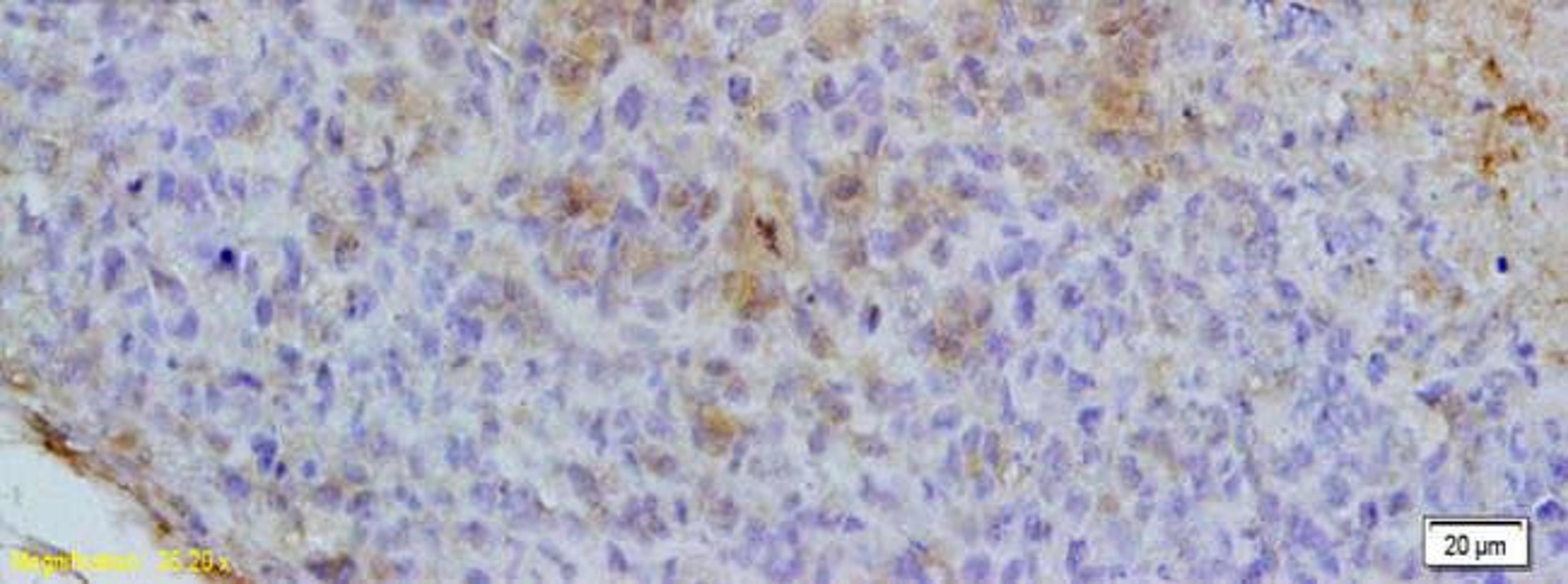 Immunohistochemical analysis of paraffin-embedded mouse lymph-gland tumour tissue using CXCL13 antibody (1:200).