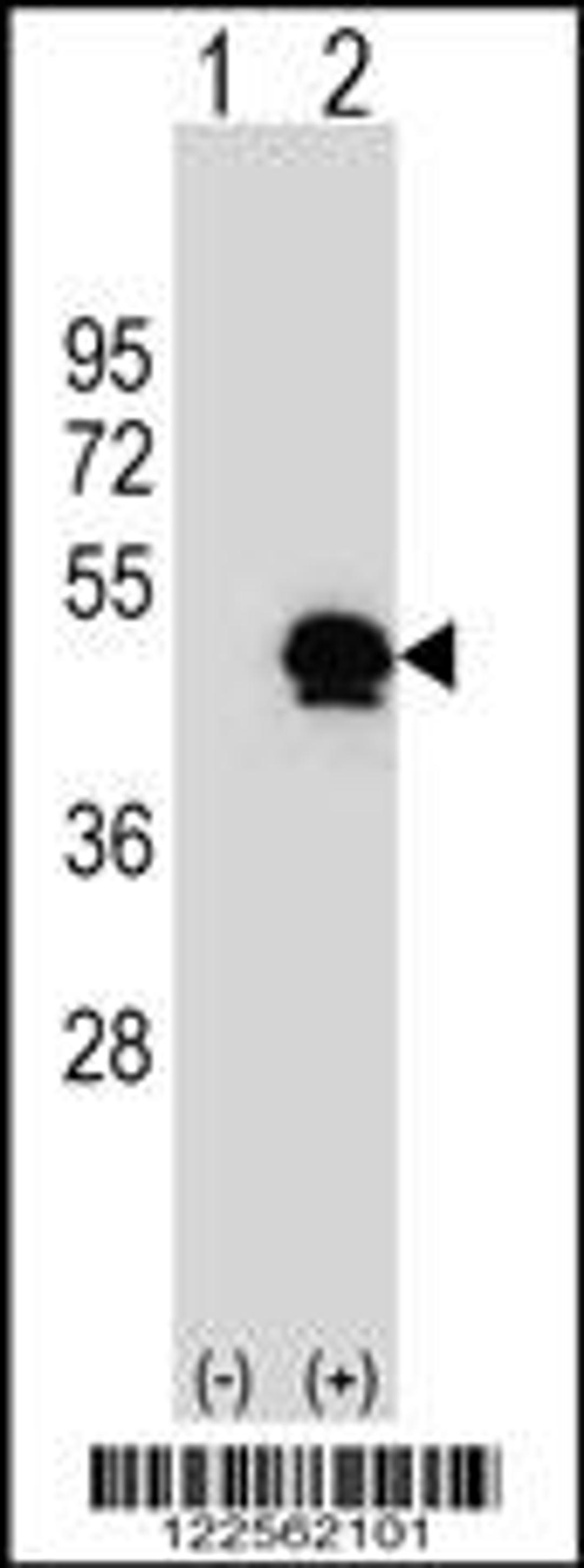 Western blot analysis of SERPINE1 using rabbit polyclonal SERPINE1 Antibody using 293 cell lysates (2 ug/lane) either nontransfected (Lane 1) or transiently transfected (Lane 2) with the SERPINE1 gene.