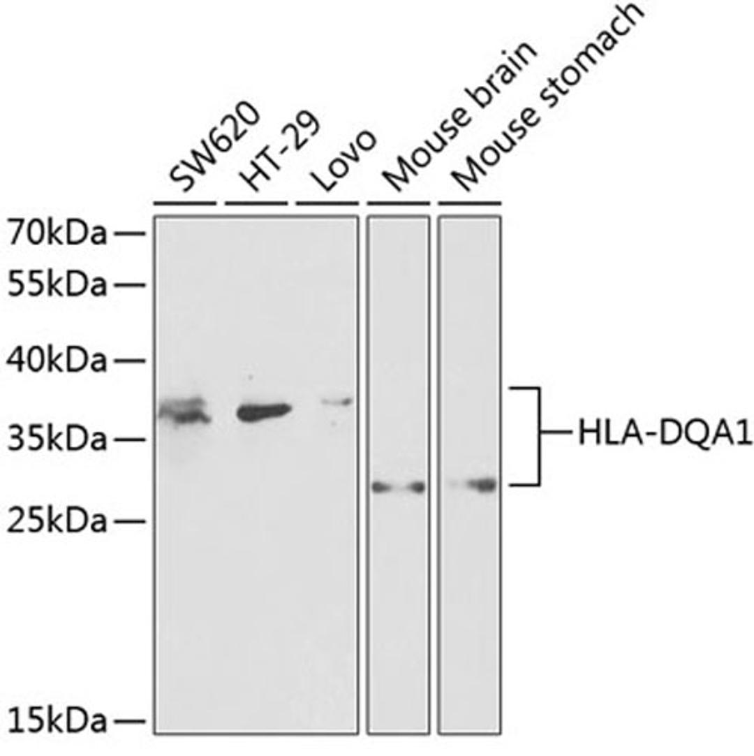 Western blot - HLA-DQA1 antibody (A2168)