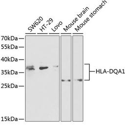 Western blot - HLA-DQA1 antibody (A2168)