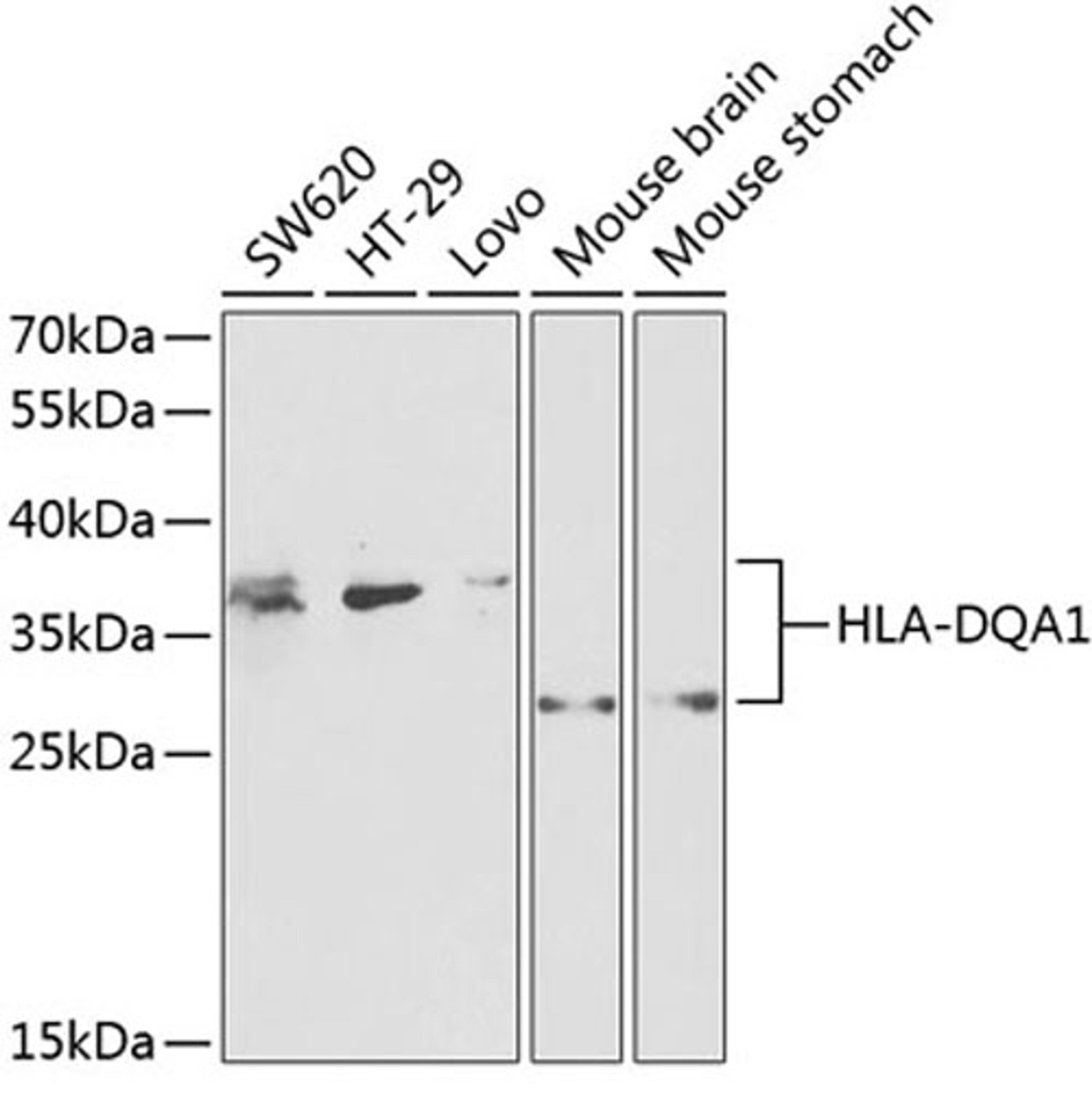 Western blot - HLA-DQA1 antibody (A2168)