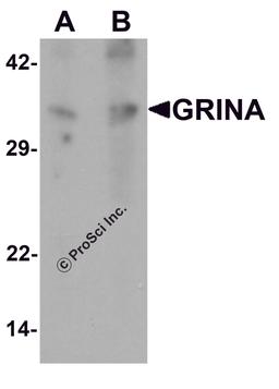 Western blot analysis of GRINA in human testis tissue lysate with GRINA antibody at (A) 1 and (B) 2 μg/mL.