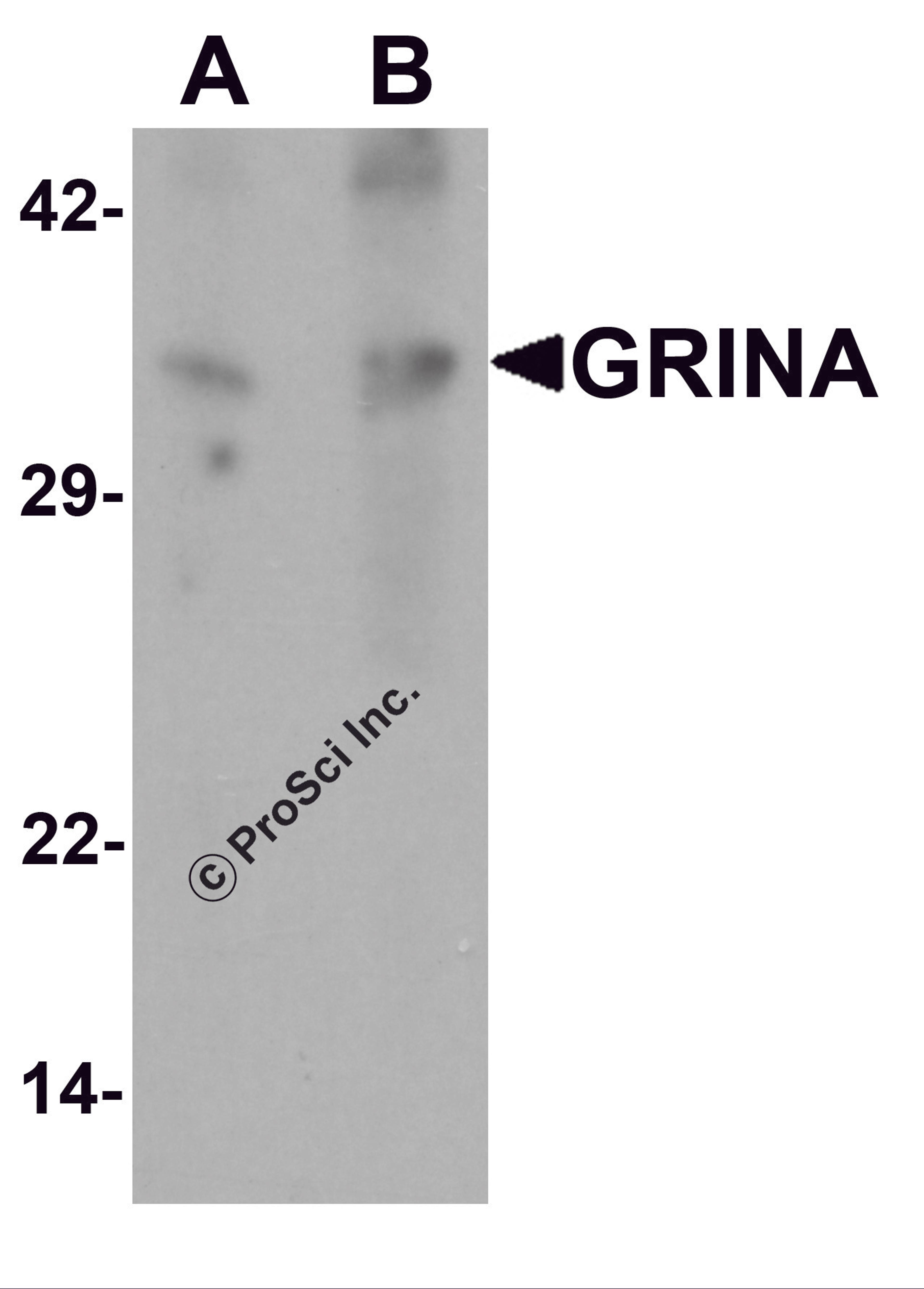 Western blot analysis of GRINA in human testis tissue lysate with GRINA antibody at (A) 1 and (B) 2 μg/mL.