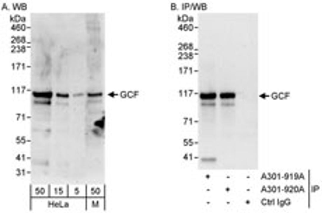 Detection of human and mouse GCF by western blot (h&m) and immunoprecipitation (h).