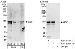 Detection of human and mouse GCF by western blot (h&m) and immunoprecipitation (h).