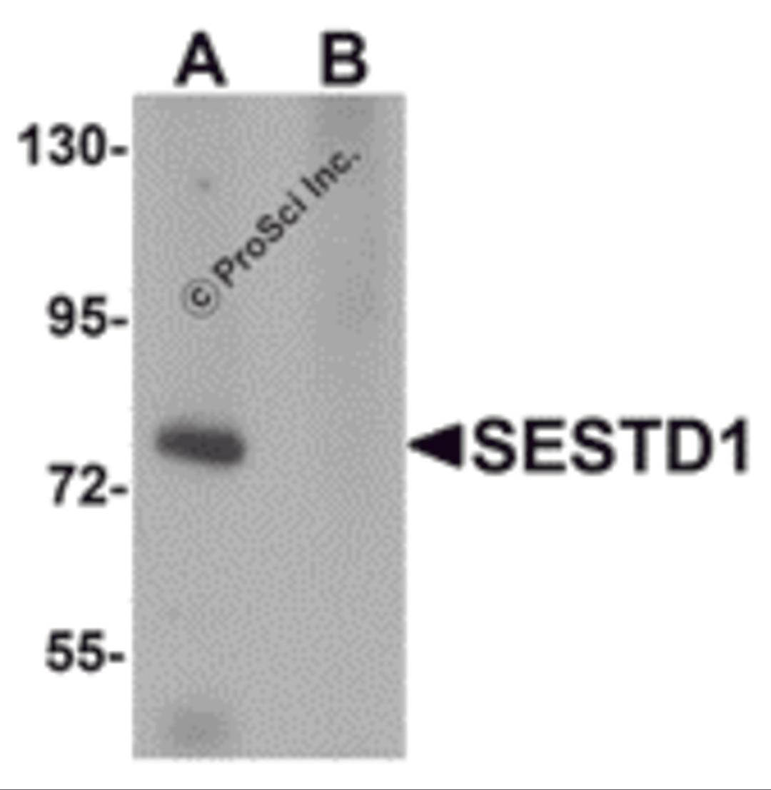 Western blot analysis of SESTD1 in rat brain tissue lysate with SESTD1 antibody at 1 μg/mL in (A) the absence and (B) the presence of blocking peptide.