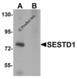 Western blot analysis of SESTD1 in rat brain tissue lysate with SESTD1 antibody at 1 μg/mL in (A) the absence and (B) the presence of blocking peptide.
