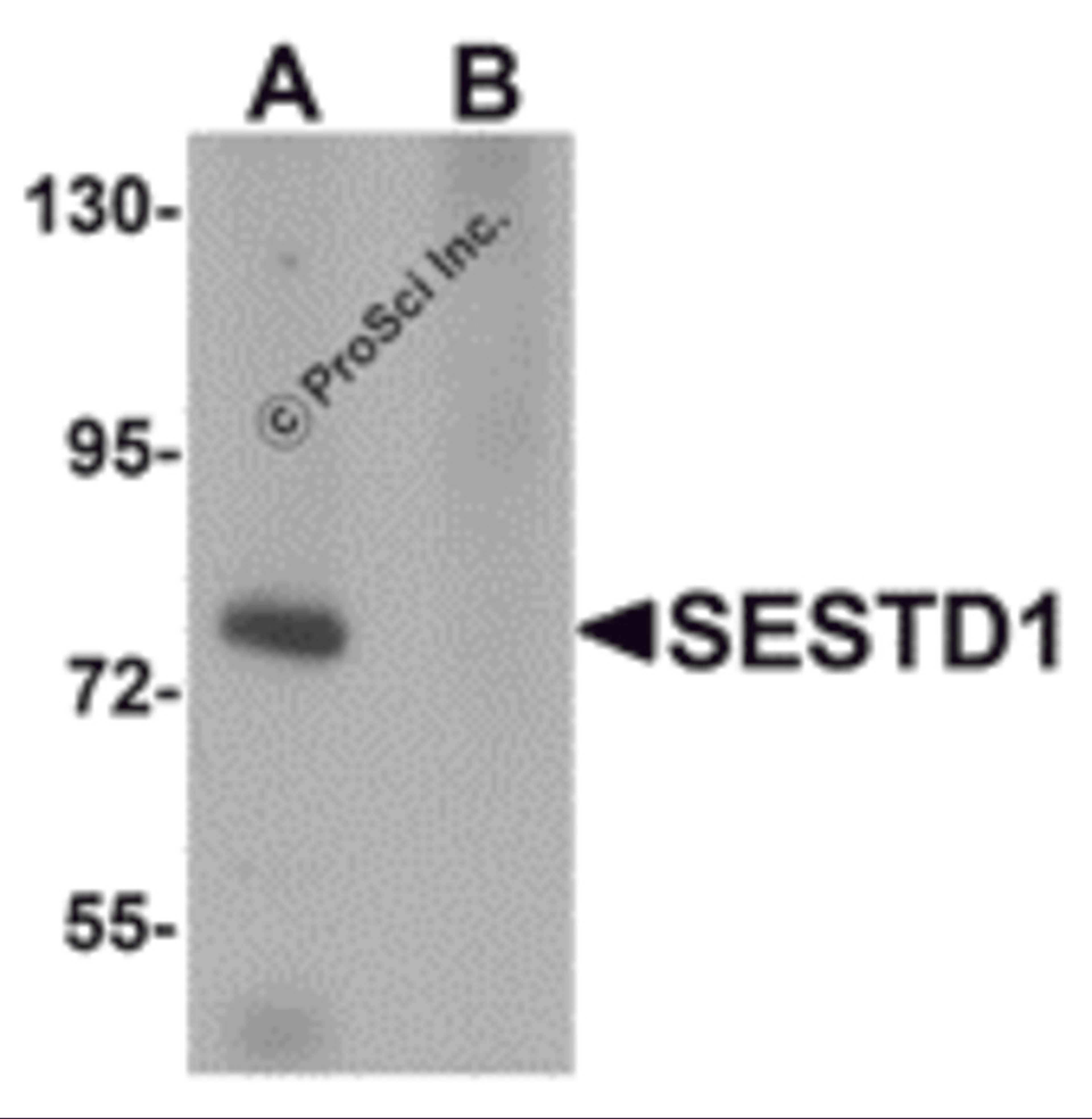 Western blot analysis of SESTD1 in rat brain tissue lysate with SESTD1 antibody at 1 μg/mL in (A) the absence and (B) the presence of blocking peptide.