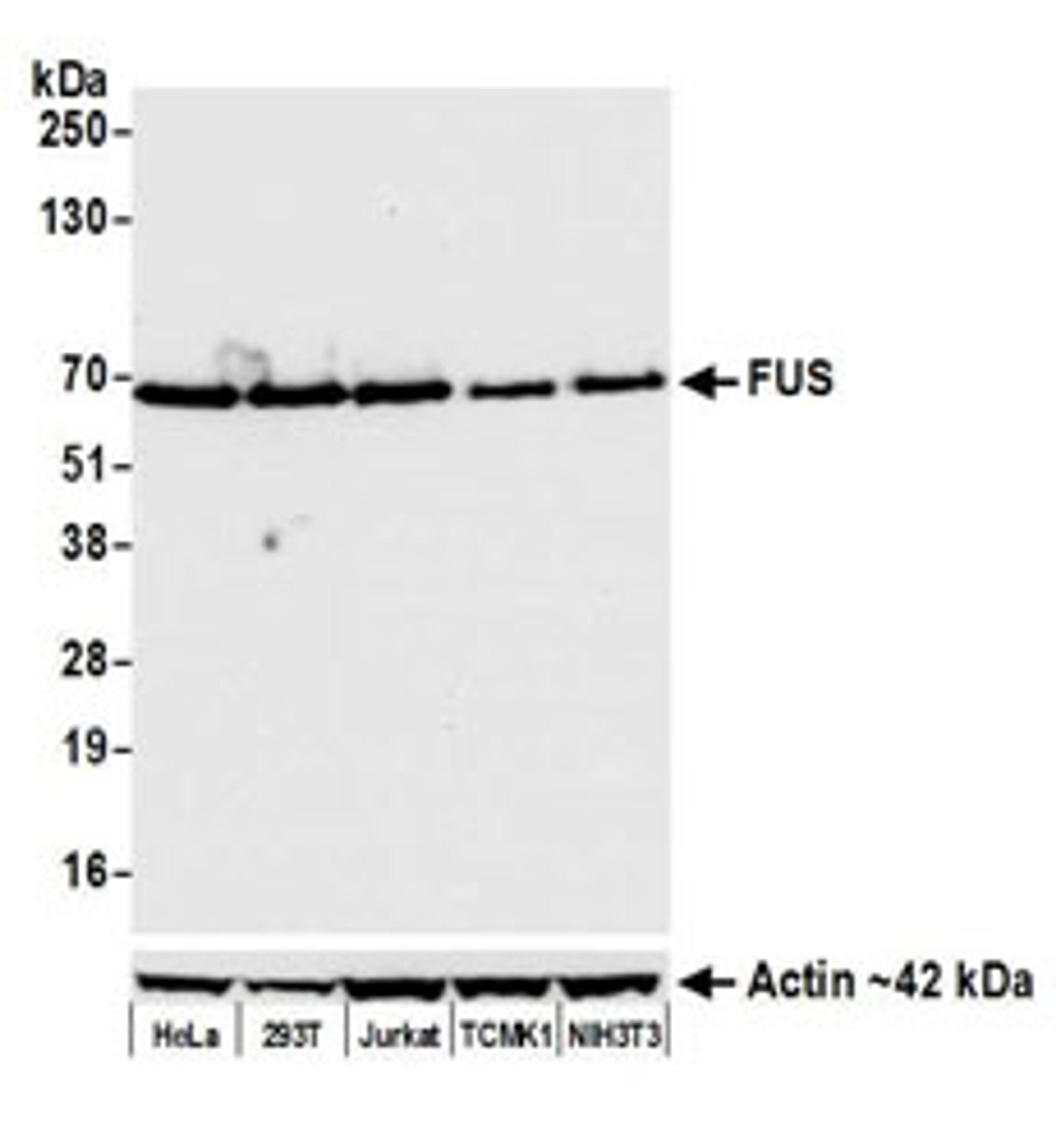 Detection of human and mouse FUS by western blot.