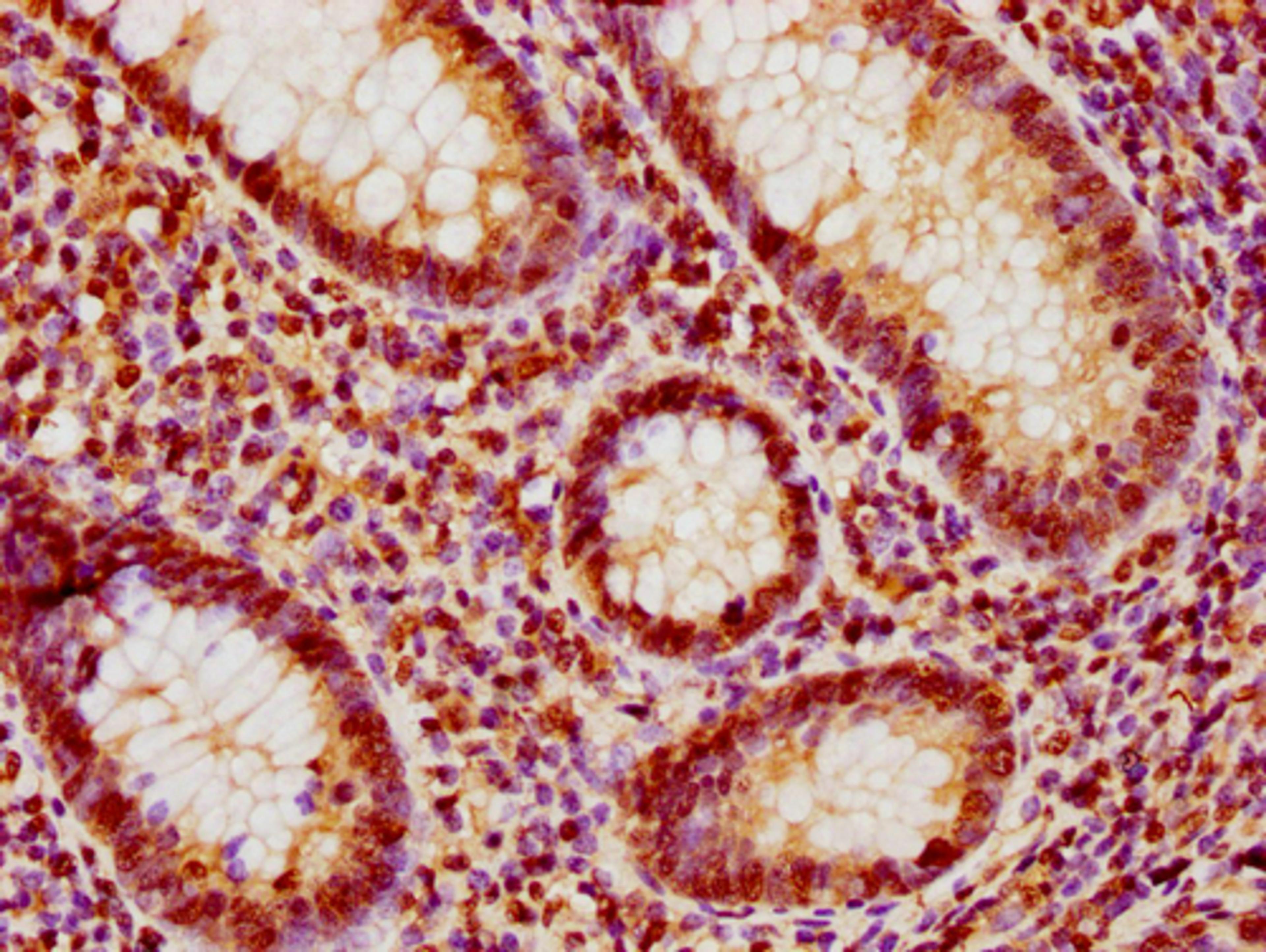 IHC image of CSB-PA010377OA188nphHU diluted at 1:10 and staining in paraffin-embedded human appendix tissue performed on a Leica BondTM system. After dewaxing and hydration, antigen retrieval was mediated by high pressure in a citrate buffer (pH 6.0). Section was blocked with 10% normal goat serum 30min at RT. Then primary antibody (1% BSA) was incubated at 4°C overnight. The primary is detected by a biotinylated secondary antibody and visualized using an HRP conjugated SP system.