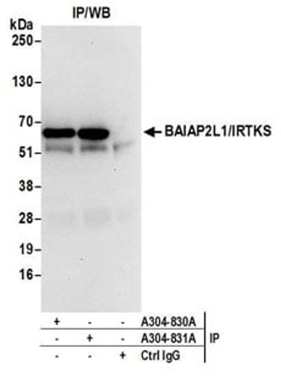 Detection of human BAIAP2L1/IRTKS by western blot of immunoprecipitates.