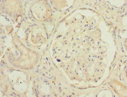 Immunohistochemistry of paraffin-embedded human kidney tissue using CSB-PA887043DSR1HU at dilution of 1:100