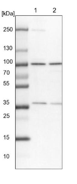 Western Blot: TBL3 Antibody [NBP1-92481] - Lane 1: NIH-3T3 cell lysate (Mouse embryonic fibroblast cells)<br/>Lane 2: NBT-II cell lysate (Rat Wistar bladder tumour cells)