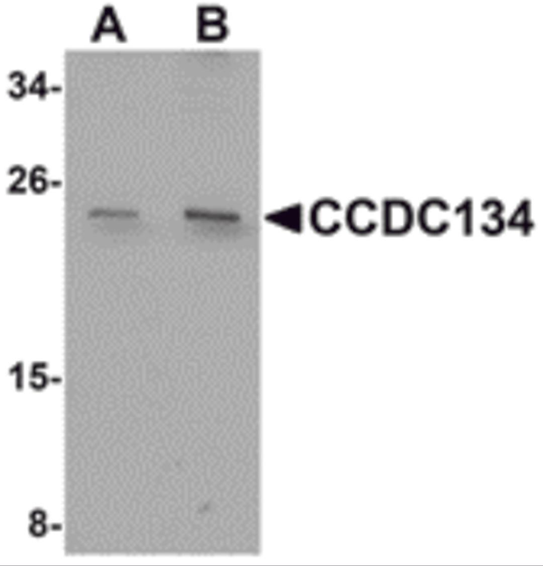 Western blot analysis of CCDC134 in rat brain tissue lysate with CCDC134 antibody at (A) 1 and (B) 2 &#956;g/mL.