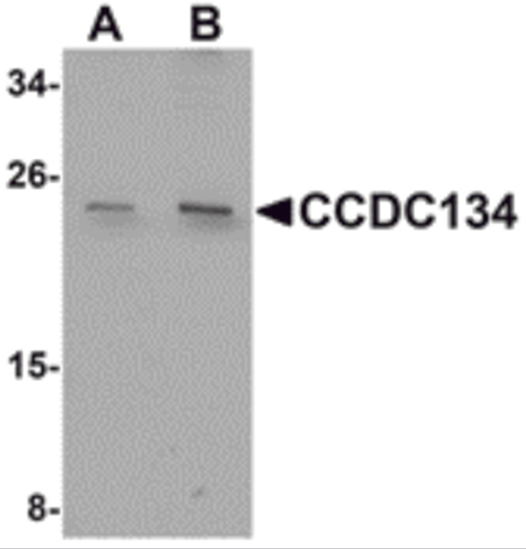 Western blot analysis of CCDC134 in rat brain tissue lysate with CCDC134 antibody at (A) 1 and (B) 2 μg/mL.