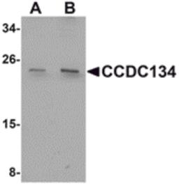 Western blot analysis of CCDC134 in rat brain tissue lysate with CCDC134 antibody at (A) 1 and (B) 2 μg/mL.