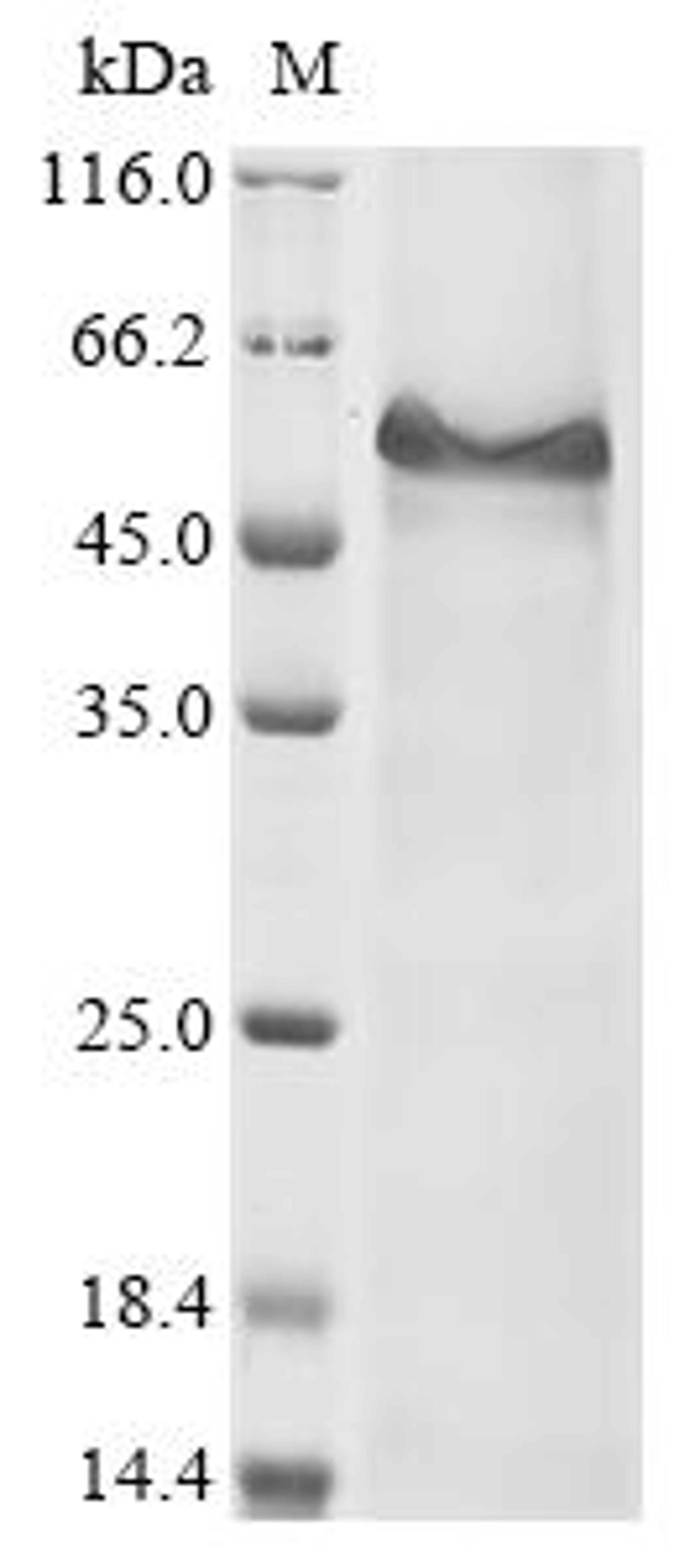 (Tris-Glycine gel) Discontinuous SDS-PAGE (reduced) with 5% enrichment gel and 15% separation gel.