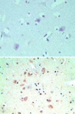 Immunohistochemistry-Paraffin: SNX2 Antibody [NBP2-24513] - Analysis of SNX2 in formalin-fixed, paraffin-embedded human brain tissue using an isotype control (top) and this antibody(bottom) at 5 ug/ml.