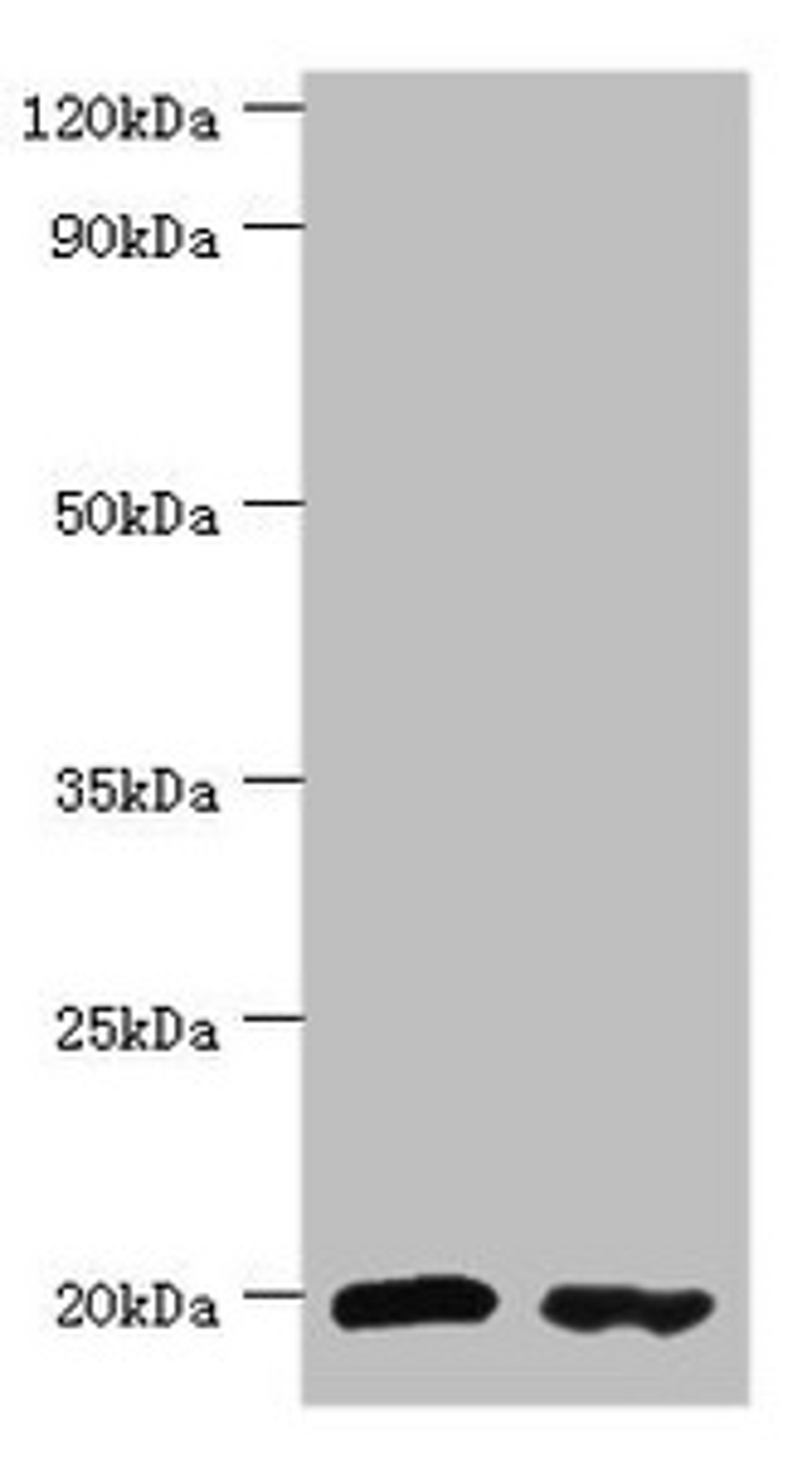 Western blot. All lanes: Peptidyl-tRNA hydrolase 2, mitochondrial antibody at 4ug/ml. Lane 1: MM231 whole cell lysate. Lane 2: Jurkat whole cell lysate. Secondary. Goat polyclonal to rabbit IgG at 1/10000 dilution. Predicted band size: 19 kDa. Observed band size: 19 kDa. 