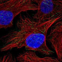 Immunocytochemistry: FRMD1 Antibody [NBP1-90832] - Immunofluorescence:  [NBP1-90832] - Staining of human cell line U-2 OS shows positivity in cytoskeleton (actin filaments).