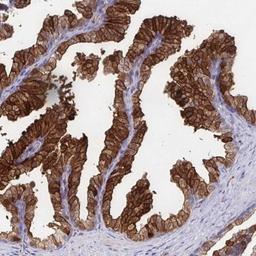 Immunohistochemistry: CDKL1 Antibody [NBP2-32482] - Staining of human prostate shows strong cytoplasmic and membranous positivity in glandular cells.