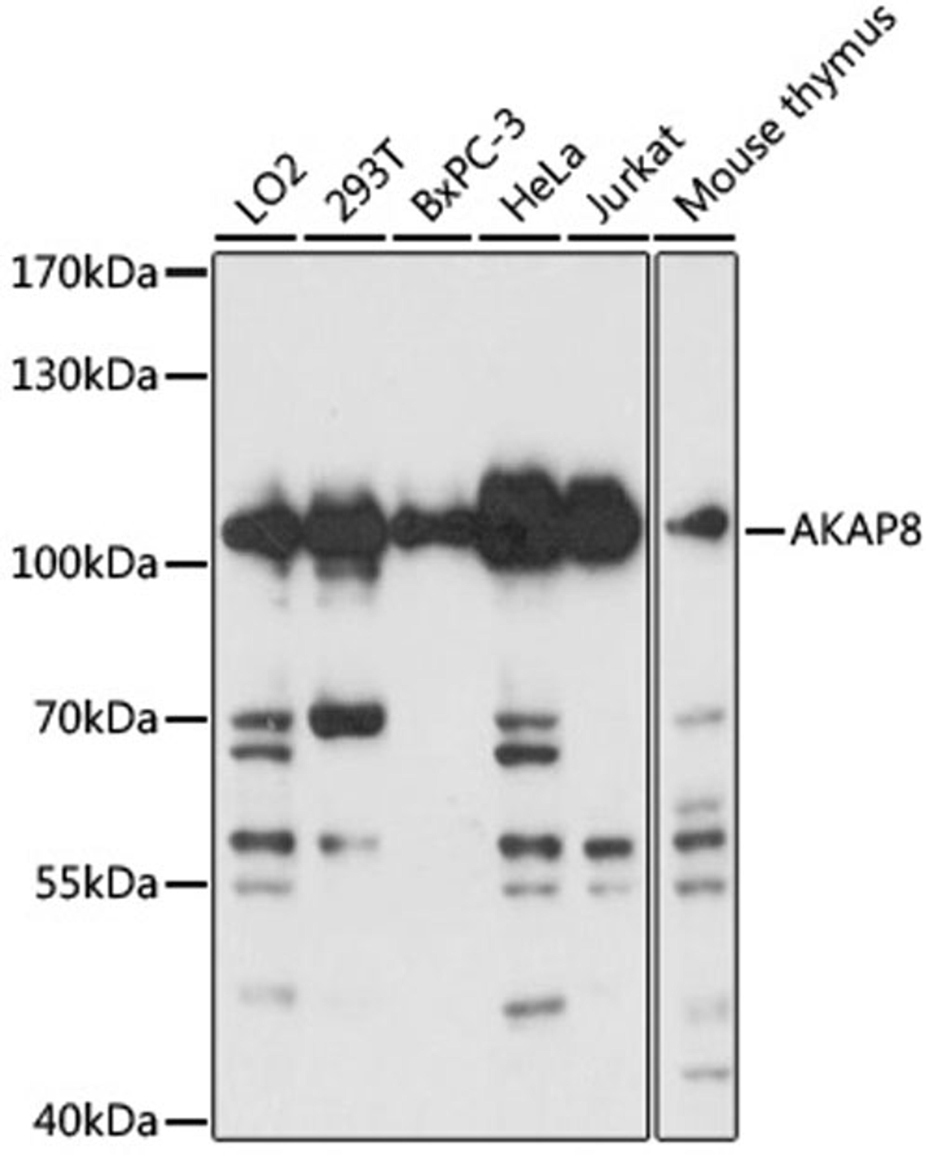 Western blot - AKAP8 antibody (A3049)