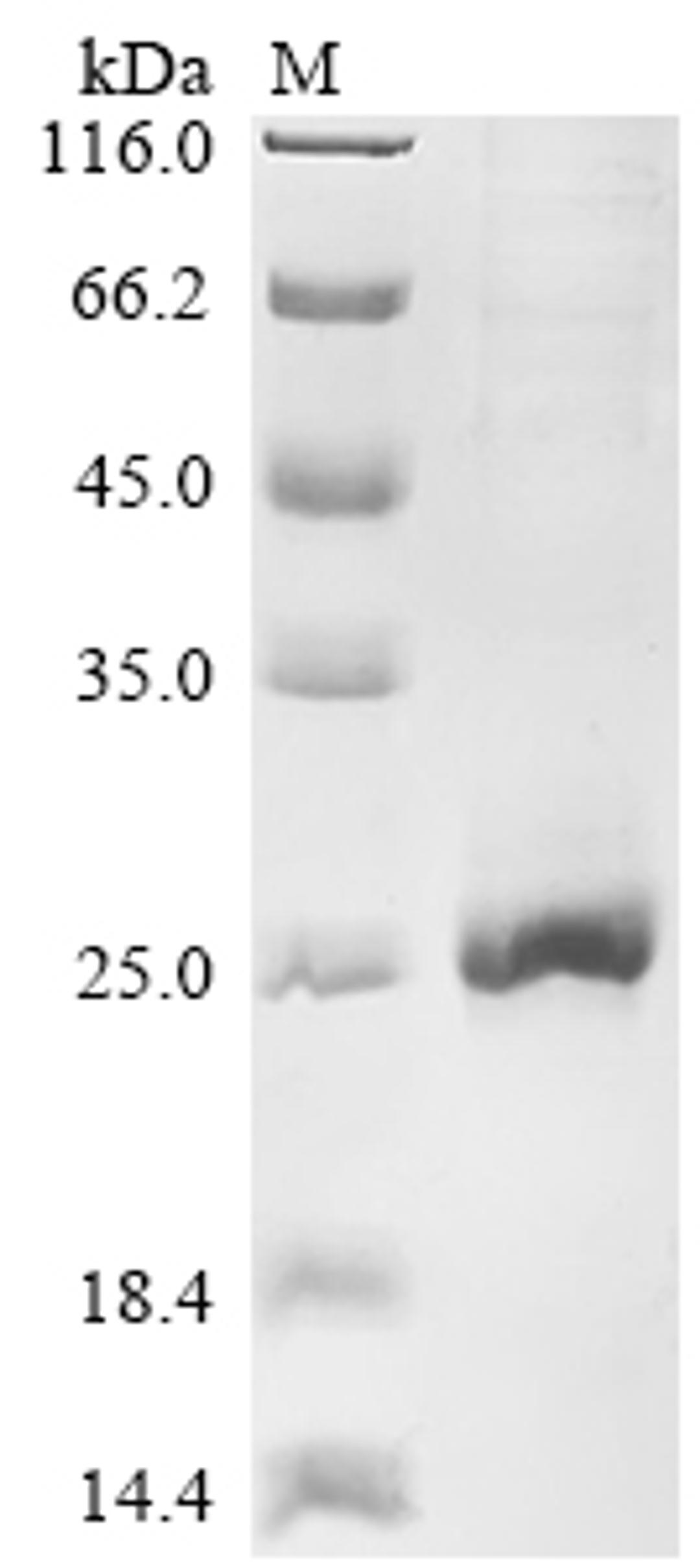 (Tris-Glycine gel) Discontinuous SDS-PAGE (reduced) with 5% enrichment gel and 15% separation gel.