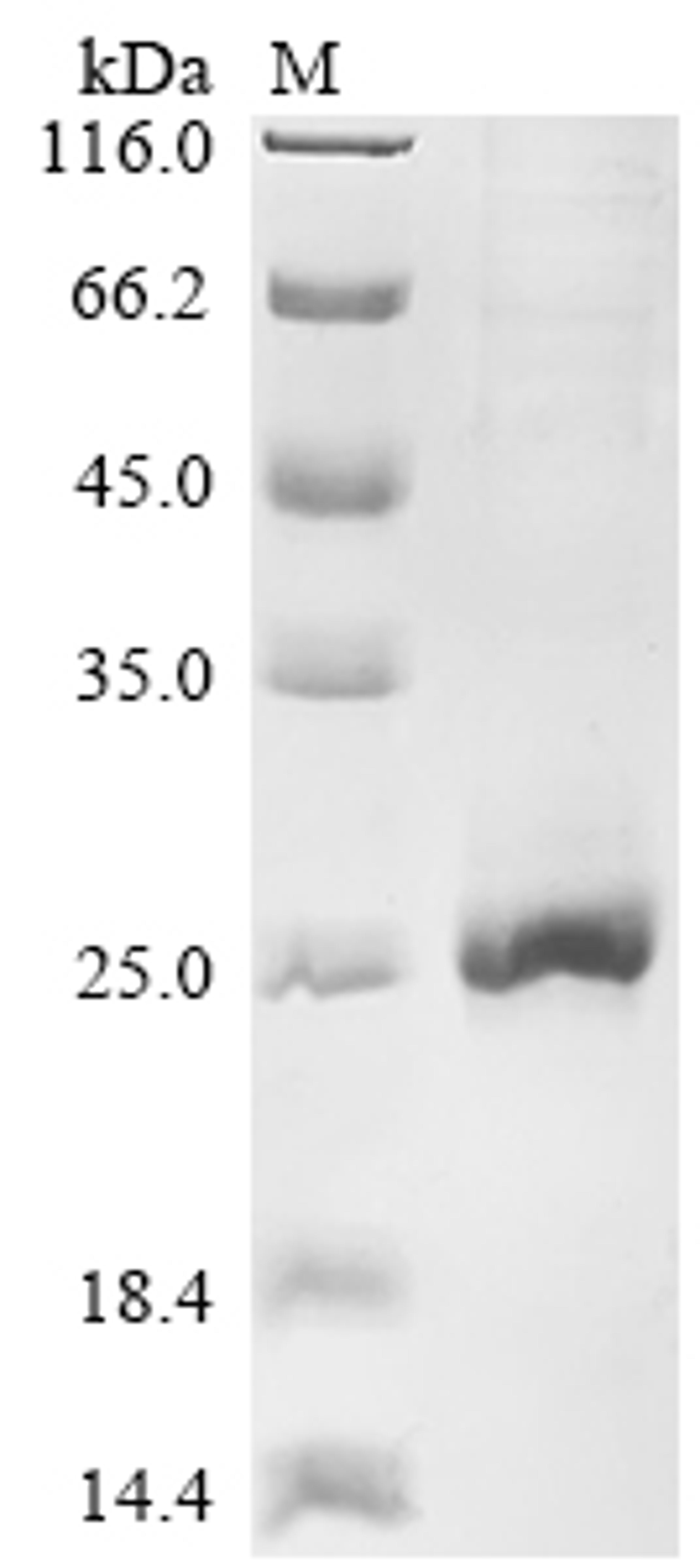 (Tris-Glycine gel) Discontinuous SDS-PAGE (reduced) with 5% enrichment gel and 15% separation gel.