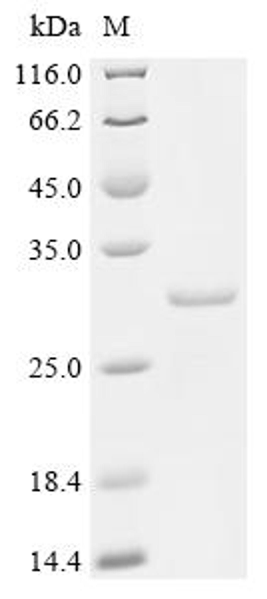 (Tris-Glycine gel) Discontinuous SDS-PAGE (reduced) with 5% enrichment gel and 15% separation gel.