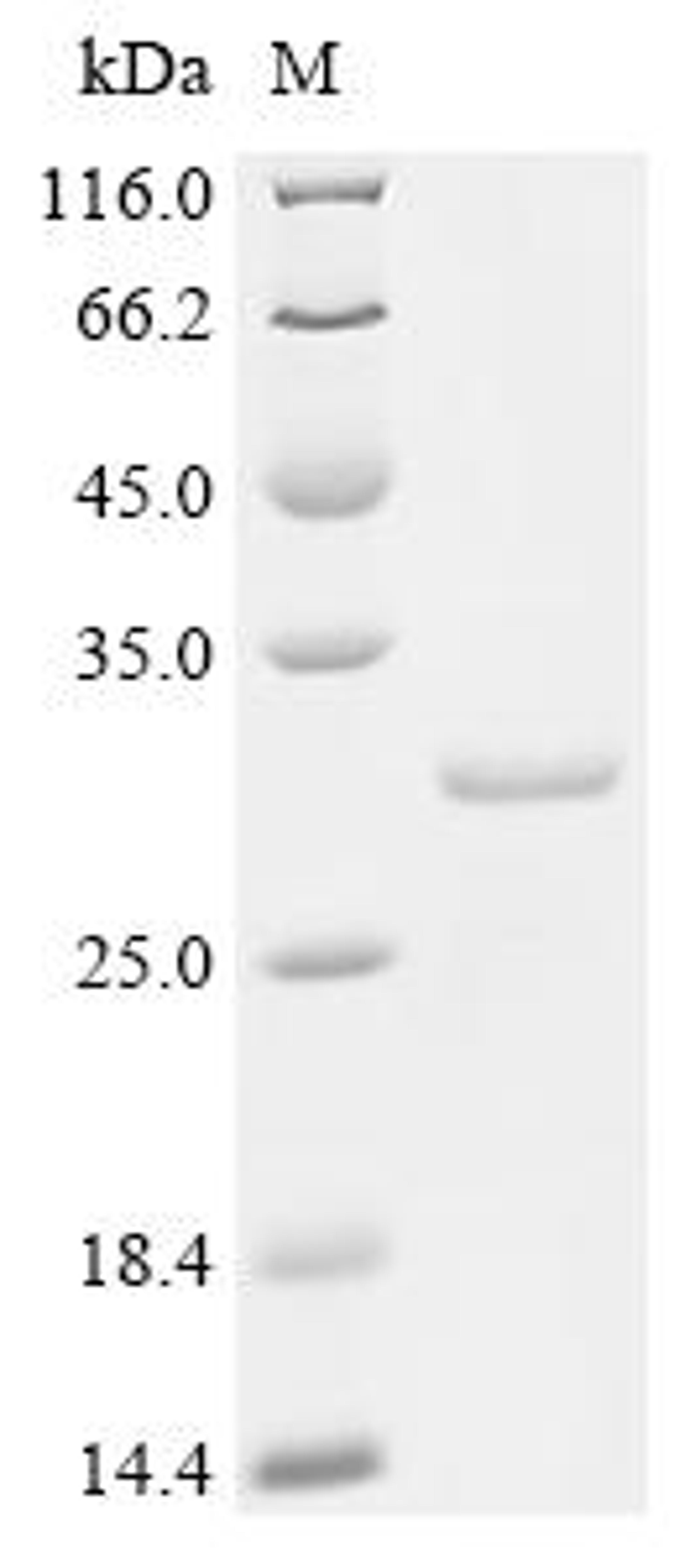 (Tris-Glycine gel) Discontinuous SDS-PAGE (reduced) with 5% enrichment gel and 15% separation gel.