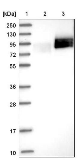 Western Blot: Splicing factor, arginine/serine-rich 11 Antibody [NBP1-87381] - Lane 1: Marker [kDa] 250, 130, 95, 72, 55, 36, 28, 17, 10<br/>Lane 2: Negative control (vector only transfected HEK293T lysate)<br/>Lane 3: Over-expression lysate (Co-expressed with a C-terminal myc-DDK tag (~3.1 kDa) in mammalian HEK293T cells, LY417764)