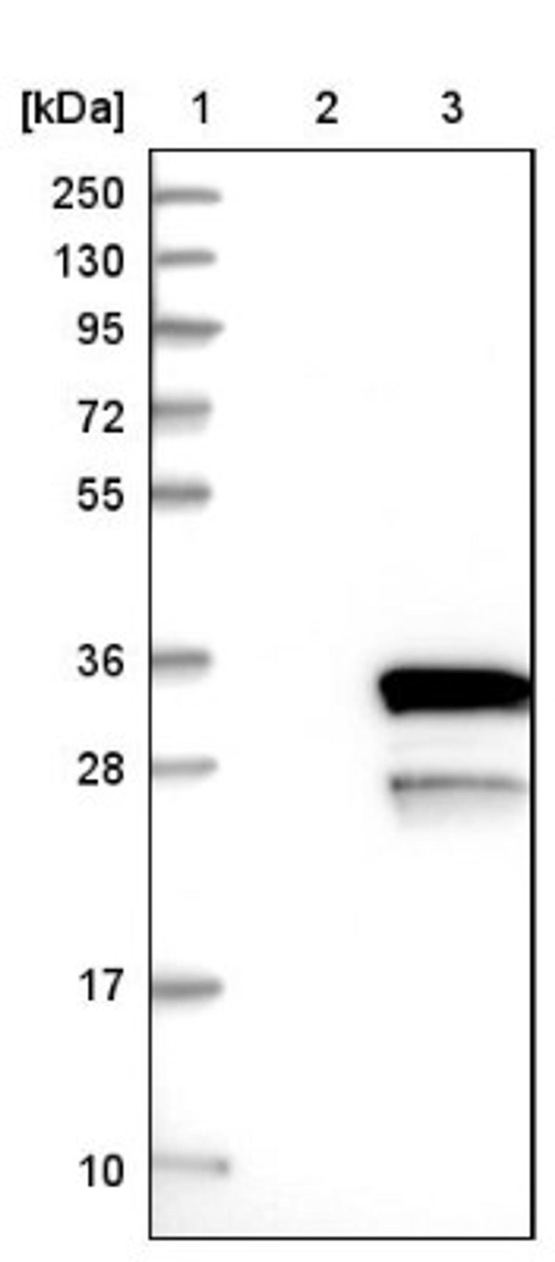 Western Blot: LYSMD1 Antibody [NBP1-81095] - Lane 1: Marker [kDa] 250, 130, 95, 72, 55, 36, 28, 17, 10<br/>Lane 2: Negative control (vector only transfected HEK293T lysate)<br/>Lane 3: Over-expression lysate (Co-expressed with a C-terminal myc-DDK tag (~3.1 kDa) in mammalian HEK293T cells, LY403895)