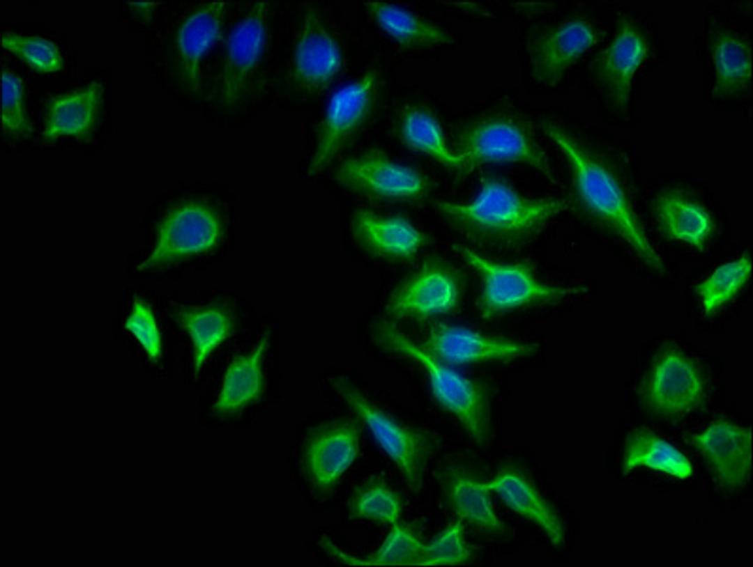 Immunofluorescence staining of A549 cells with CSB-PA002409LA01HU at 1:133, counter-stained with DAPI. The cells were fixed in 4% formaldehyde, permeabilized using 0.2% Triton X-100 and blocked in 10% normal Goat Serum. The cells were then incubated with the antibody overnight at 4&deg;C. The secondary antibody was Alexa Fluor 488-congugated AffiniPure Goat Anti-Rabbit IgG(H+L).
