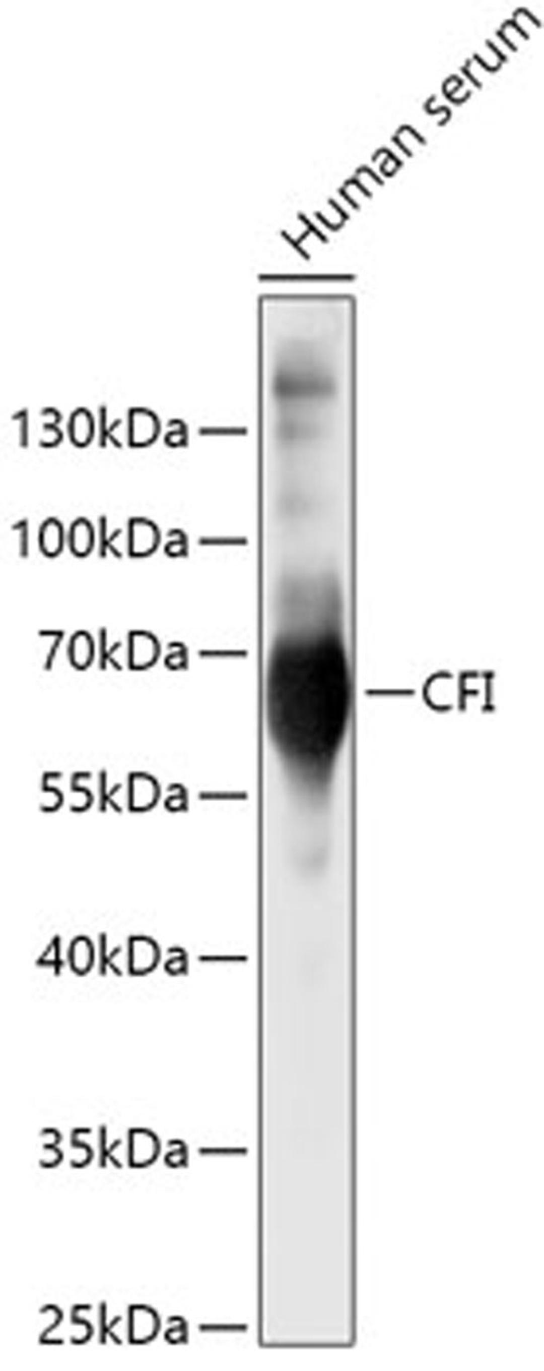 Western blot - CFI antibody (A5623)