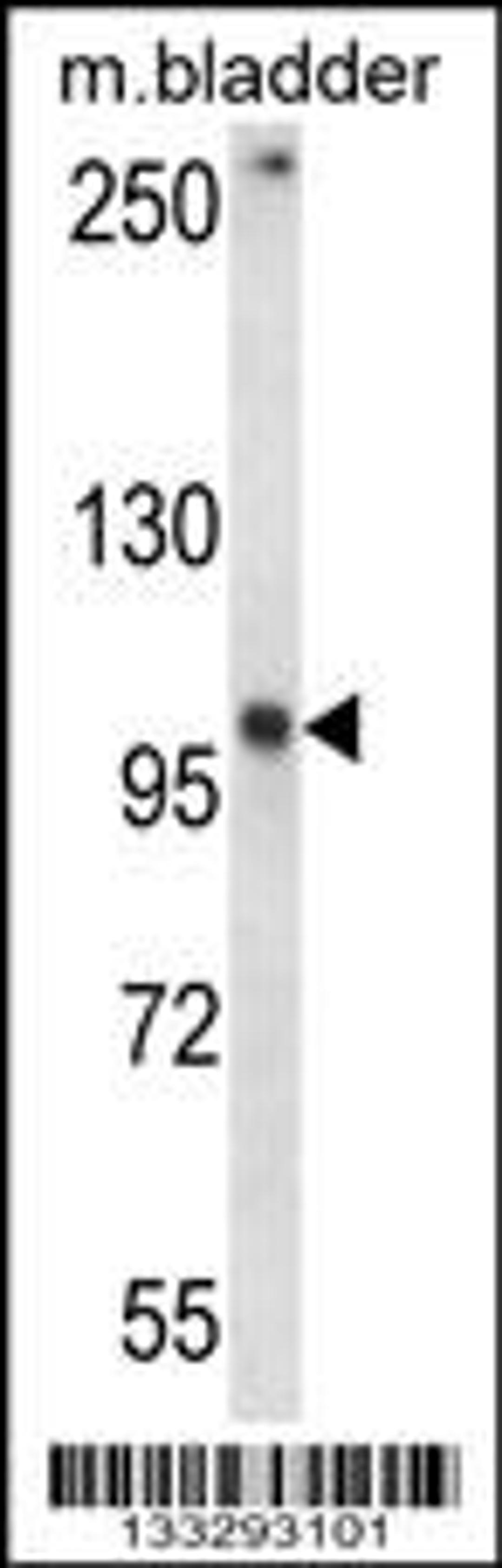 Western blot analysis in mouse bladder tissue lysates (35ug/lane).