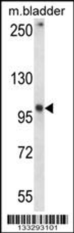 Western blot analysis in mouse bladder tissue lysates (35ug/lane).