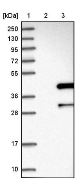 Western Blot: ANKRD23 Antibody [NBP1-90599] - Lane 1: Marker [kDa] 250, 130, 95, 72, 55, 36, 28, 17, 10<br/>Lane 2: Negative control (vector only transfected HEK293T lysate)<br/>Lane 3: Over-expression lysate (Co-expressed with a C-terminal myc-DDK tag (~3.1 kDa) in mammalian HEK293T cells, LY408133)