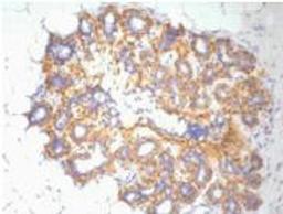 IHC Staining of Human ovary tissue, diluted at 1:200