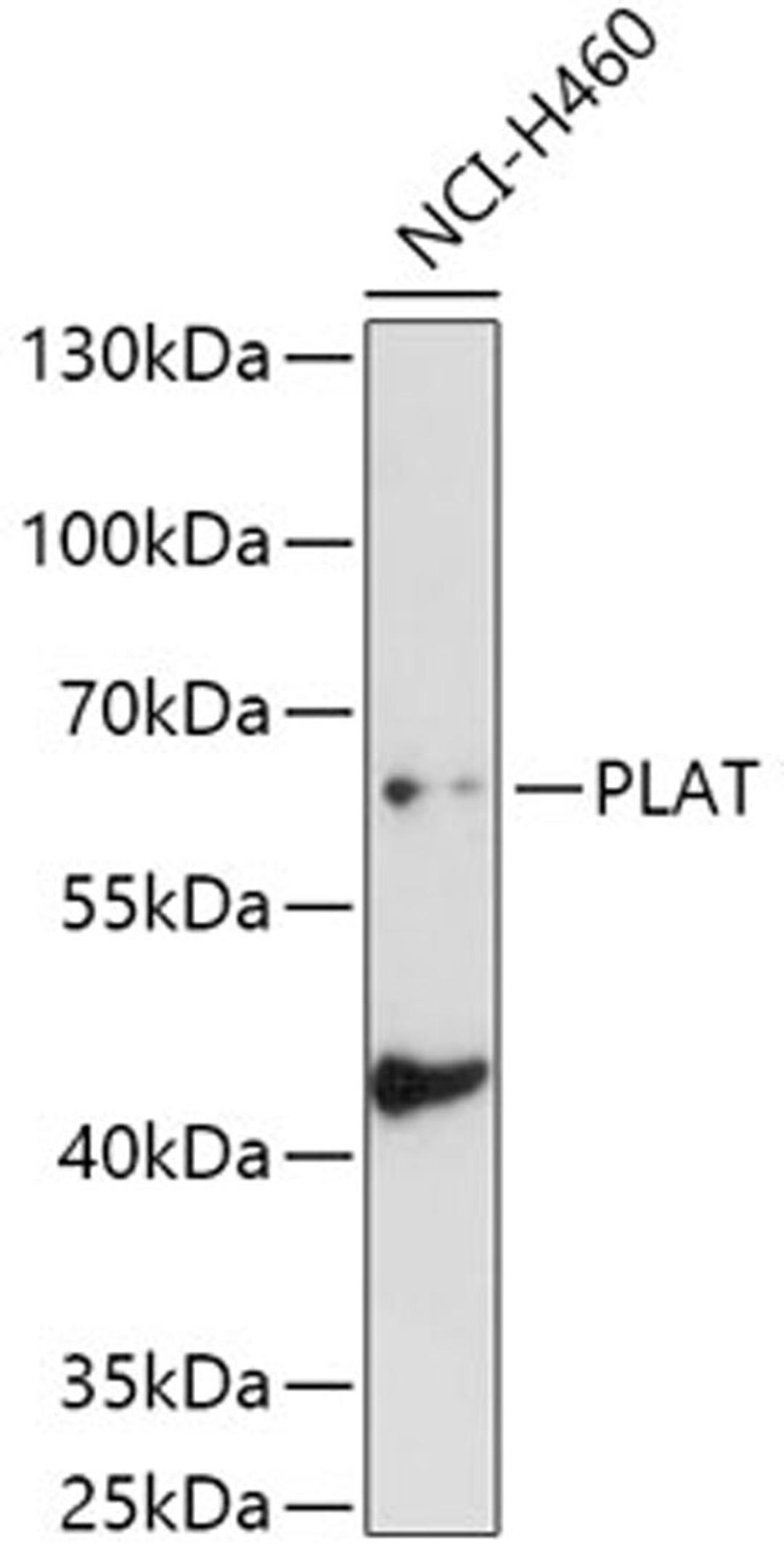 Western blot - PLAT antibody (A5655)