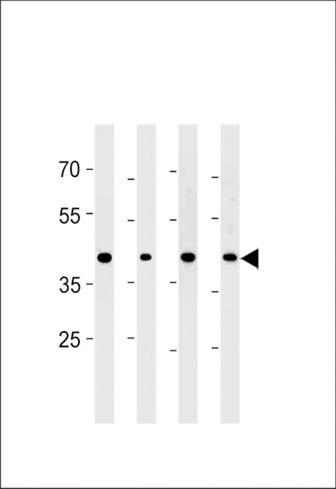 Western blot analysis in PC-3 cell line and mouse brain,testis and liver lysates (35ug/lane).