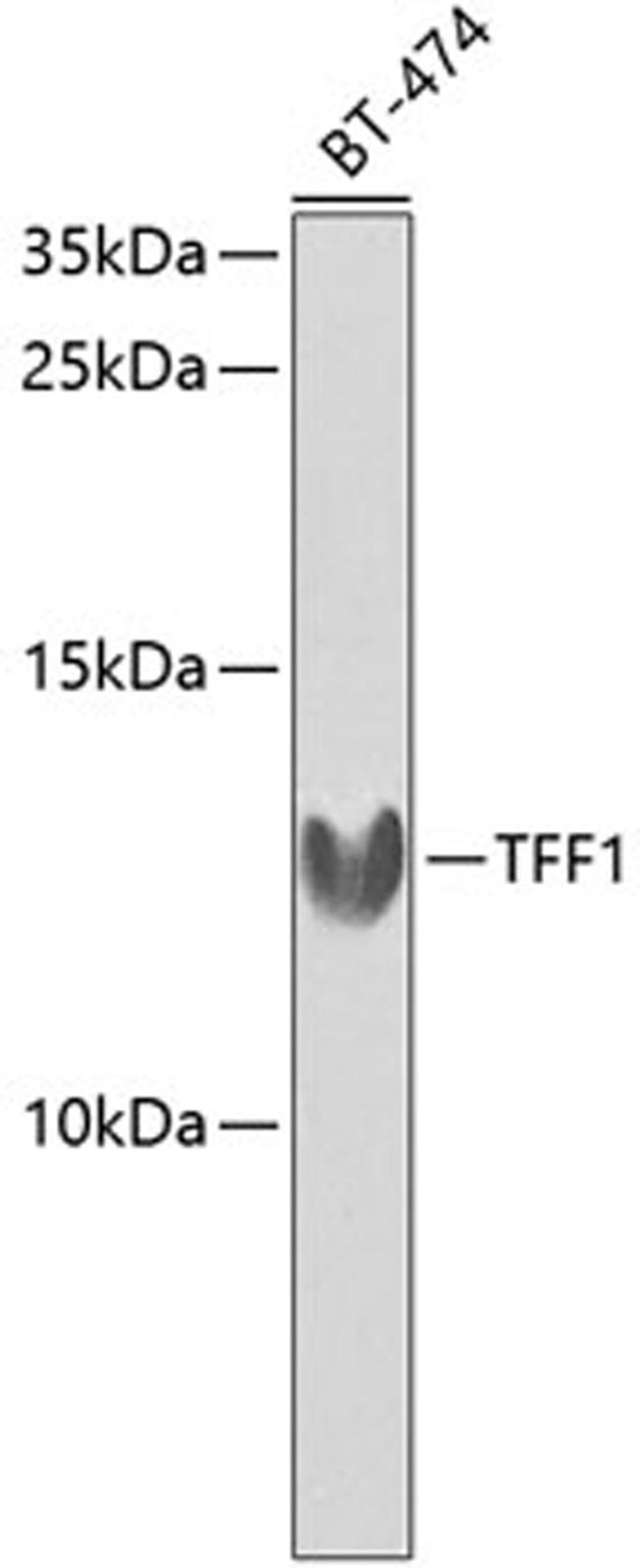 Western blot - TFF1 antibody (A1789)